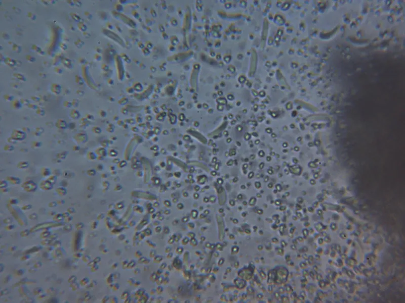 Cytospora nivea 14 - Nodulos superficie agua